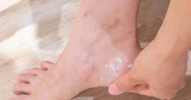Kem gót chân Shiseido Urea Cream 60g có tác dụng gì?-1