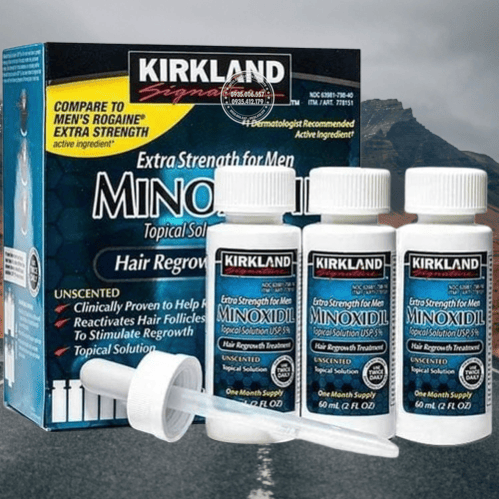 thuoc-moc-toc-minoxidil-co-tot-khong-su-that-tu-chuyen-gia