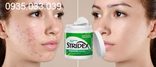alcohol-free-stridex-maximum-review-chi-tiet-co-dang-mua-khong1