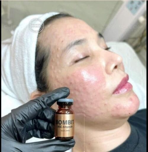 serum-tre-hoa-da-bombit-hsc-ampoule-review-co-tot-khong-su-that-tu-nguoi-dung1